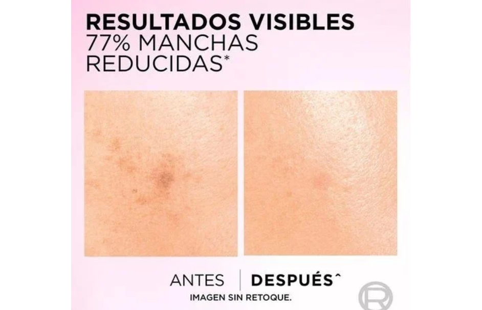 Manchas oscuras en la piel